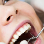 歯周病の治療方法と流れについて