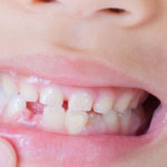 乳歯から永久歯へ！歯の役割と歯が生え揃う仕組みについて