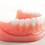 歯がなくなったときのために。歯科治療で欠損補綴が大切なワケ